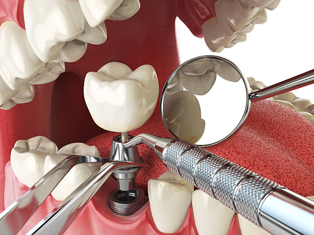 Best Walk-In Emergency Dentist in Struthers, OH